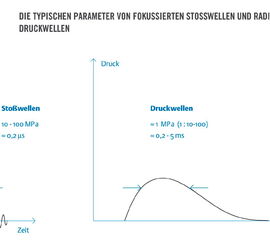 Druckverlauf und Geschwindigkeit einer fokussierten Stoßwelle links und radialer Druckwelle rechts (Mit freundlicher Genehmigung der Storz Medical)