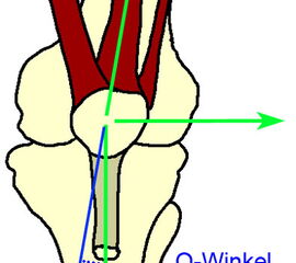 Der Q-Winkel als ein zentraler Parameter für die Stellung der gesamten unteren Extremität