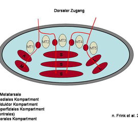 Der dorsale Zugang als Doppelzugang (n.Frink et al. <a class=