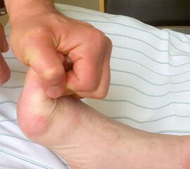 Selektive Kraftprüfung des MTA: Durch die Fixierung der Zehen in Hyperextension werden die Zehenstrecker funktionell ausgeschaltet. Damit kann die Kraft des MTA selektiv getestet werden.