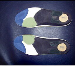 Schicht 5 als Bezug der Bettung (Plastazote); nach Einbau und Probetragen der Einlage wird die Bettung mit Plastazote 2-4mm bezogen